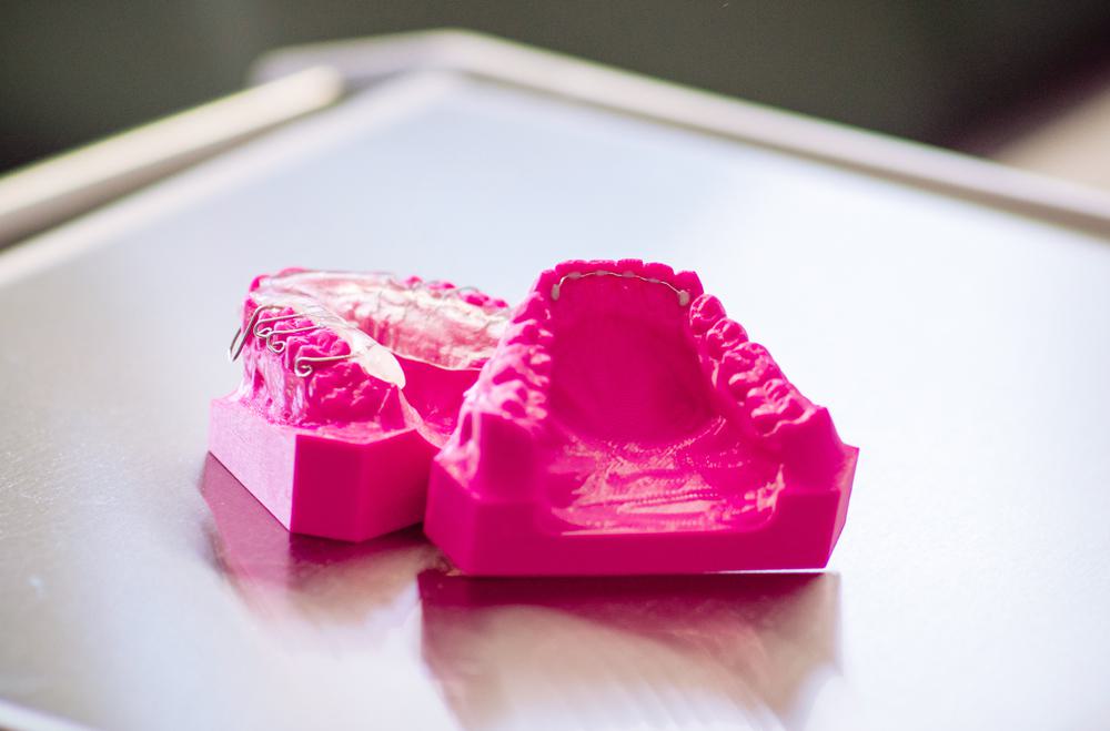 Spange ohne Abdrücke