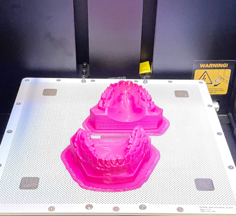 Spange ohne Abdrücke